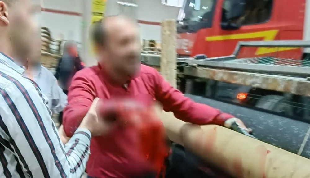 Fabrikada feci iş kazası! Ellerini silindir makinesine kaptırdı..